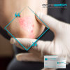 Allantoin-Concern-001.png coresatin® Allantoin Soothing Care for Sensitive Skin, 30 g