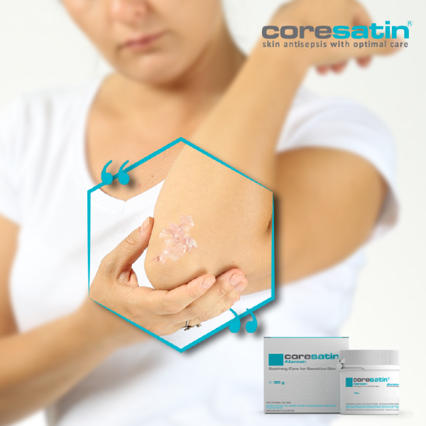 Allantoin-Concern-002.png coresatin® Allantoin Soothing Care for Sensitive Skin, 30 g