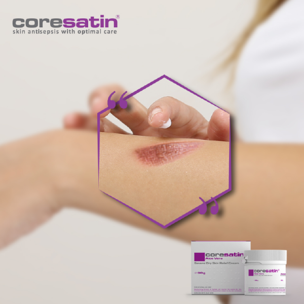 AloeVera-Concern-002.png coresatin® Aloe Vera Severe Dry Skin Relief Cream, 30 g
