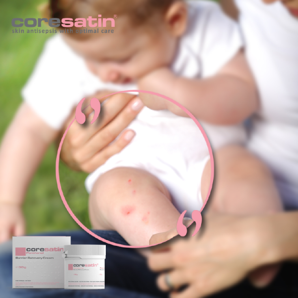 coresatin® Panthenol Barrier Recovery Cream, 30 g