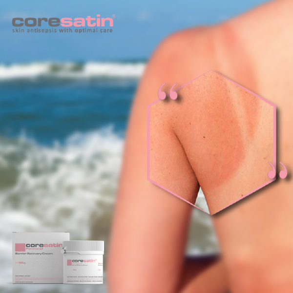 coresatin® Panthenol Barrier Recovery Cream, 30 g