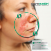 coresatin® Propolis Itch Relief - Purifying Cream, 30 g