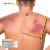 coresatin® Sea Buckthorn Relief Cream for Redness and Squames, 30 g